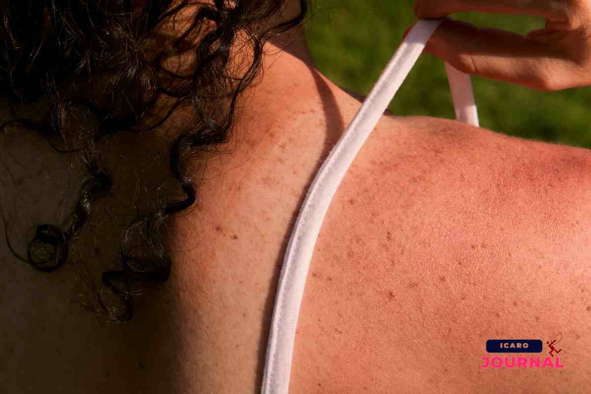 Scottature crema naturale - IcaroJournal