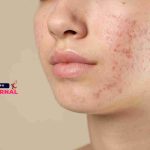 Caprese vecchio stile, devi scegliere bene la mozzarella per farla (anche per la versione senza lattosio)