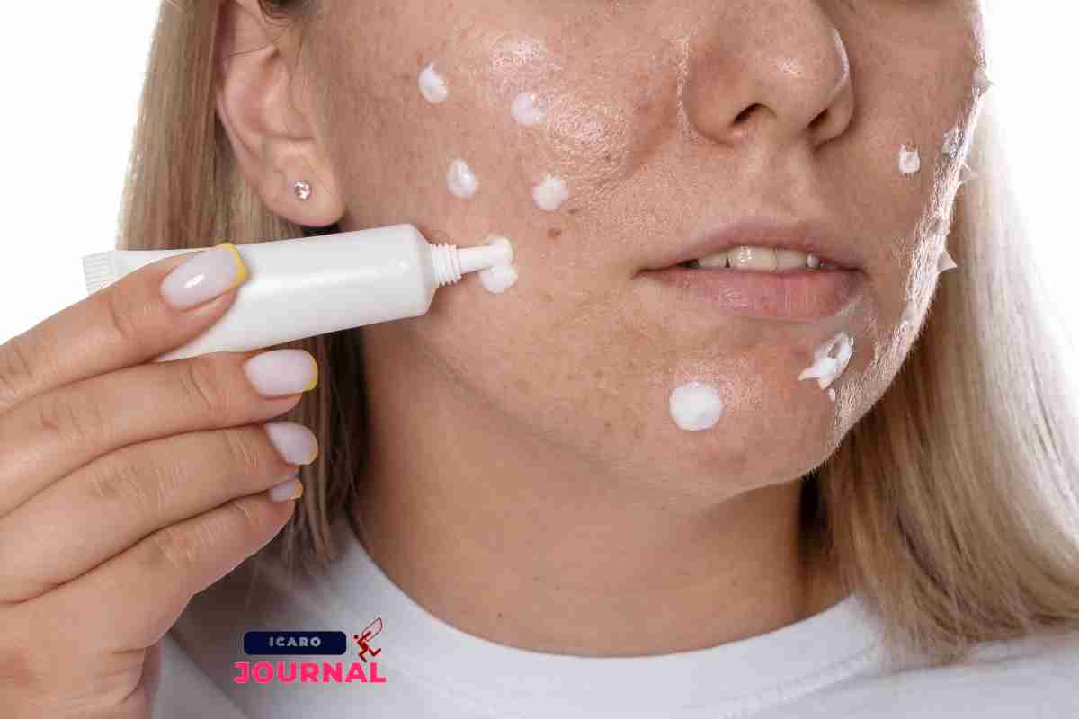 Brufoli come agire - IcaroJournal