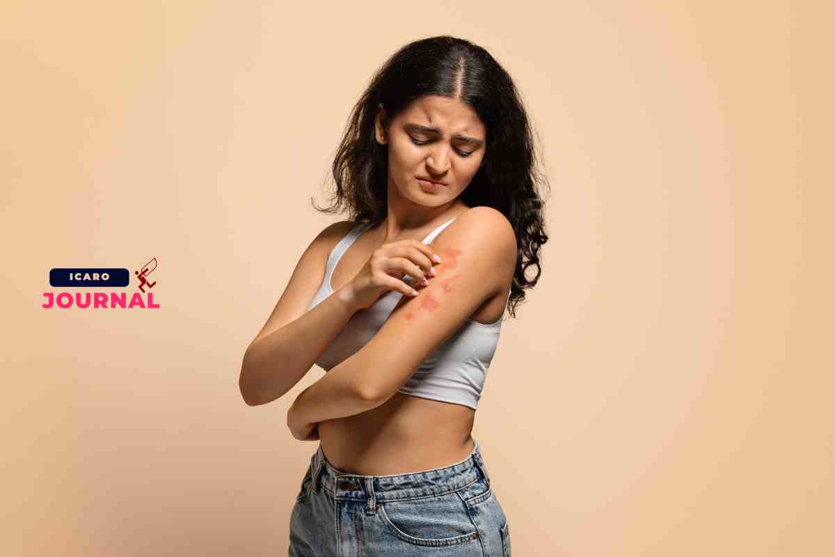 Rimedi naturali contro il prurito - IcaroJournal