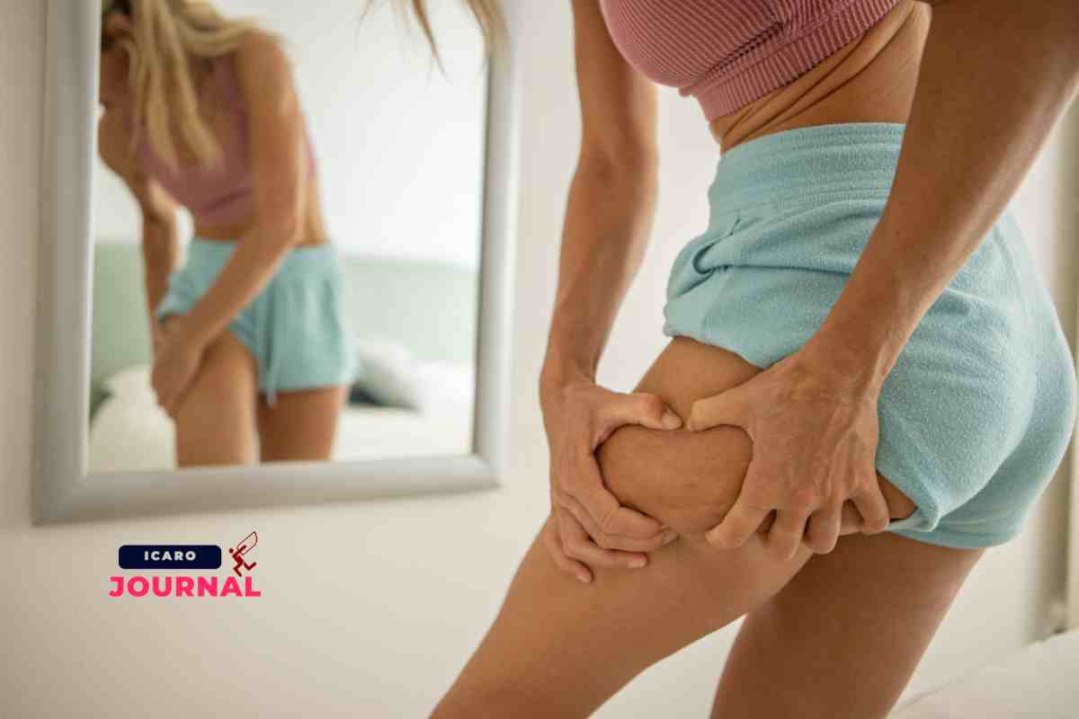 Cellulite problema al femminile come risolverlo - IcaroJournal