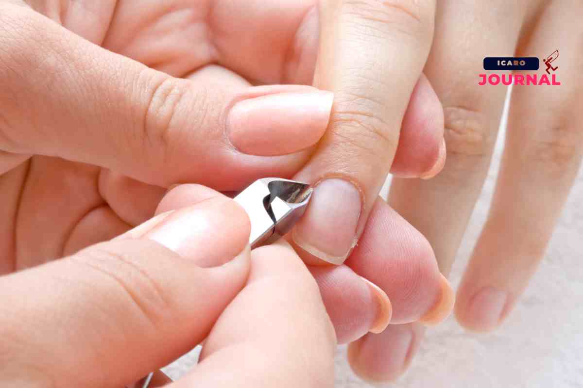 Cuticole che dolore - IcaroJournal