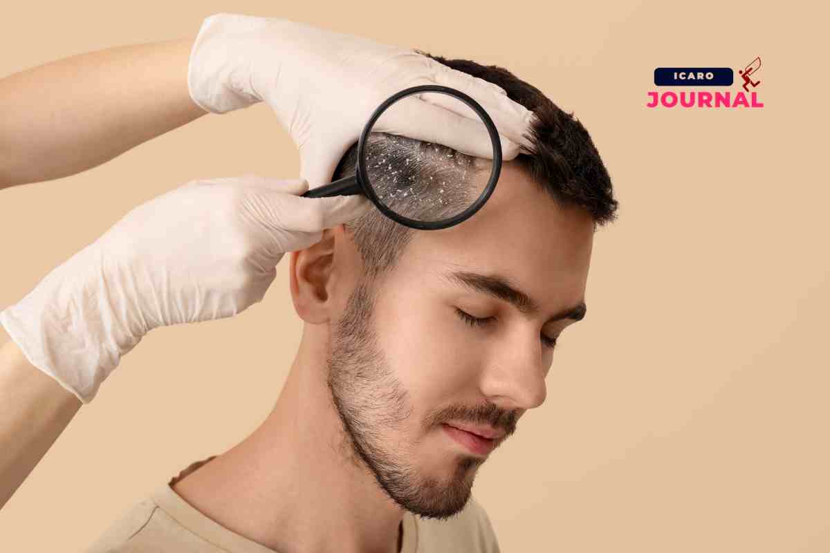 Scrub per capelli - IcaroJournal